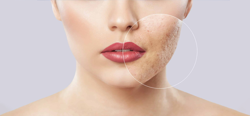 کاربرد پروبیوتیک ها در نوشیدنی ها Use of probiotics in beverages